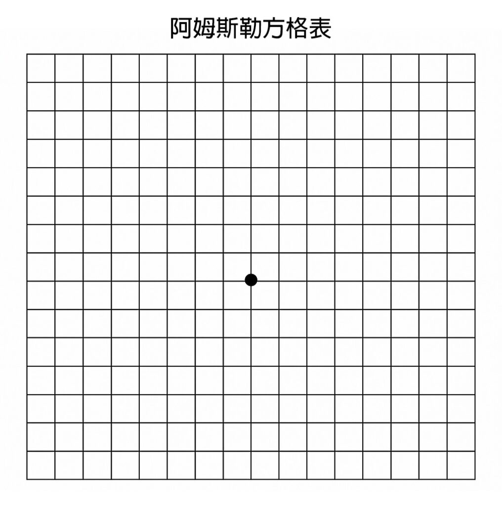 阿姆斯勒方格表